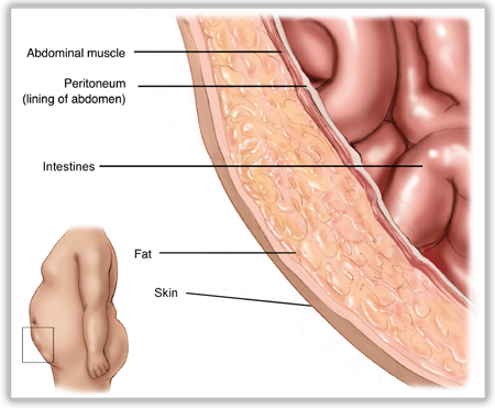 Layers of the Abdominal Wall